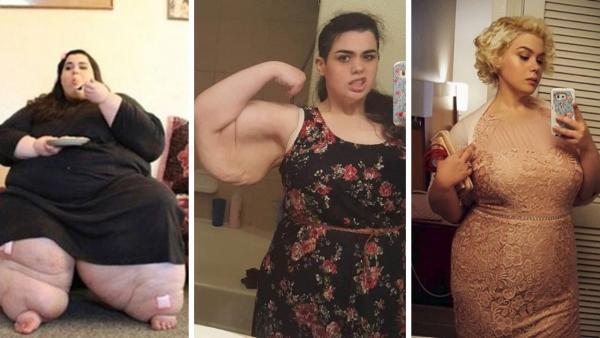 Hon vägde 272 kg men har gått ner över 180 kg - ser hur hon ser ut idag
